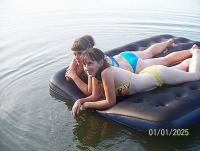 Фотография ecchymosis