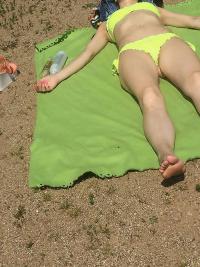 Фотография metritis